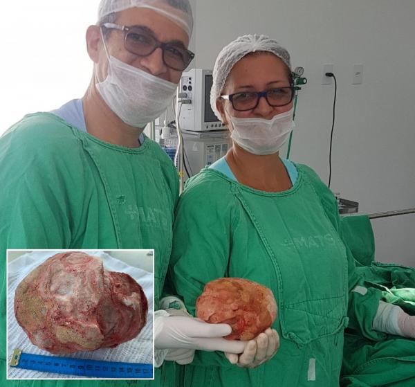 Lavrador de 51 anos tem pedra de 1,3 Kg e 18 cm retirada da bexiga em cirurgia na Bahia; VEJA