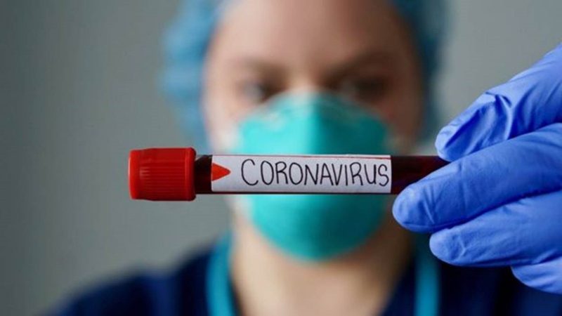 Nova atualização: Brasil tem 159 mortes por coronavírus e 4.579 infectados