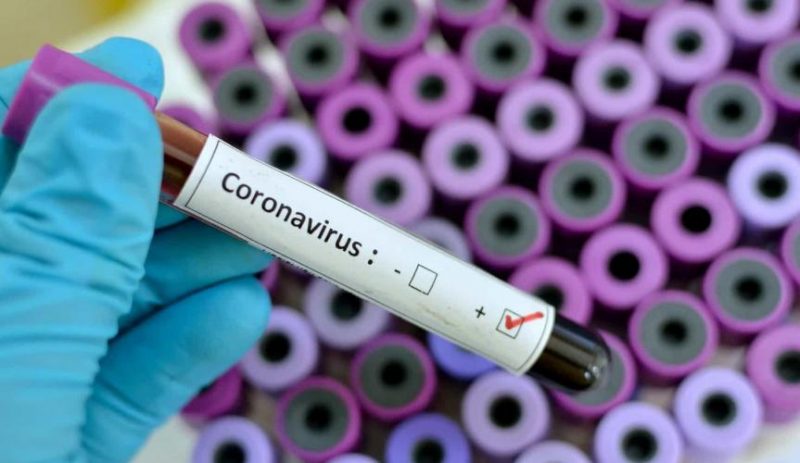 Coronavírus: Bahia confirma 1° caso do vírus; este é o 9° caso confirmado no Brasil