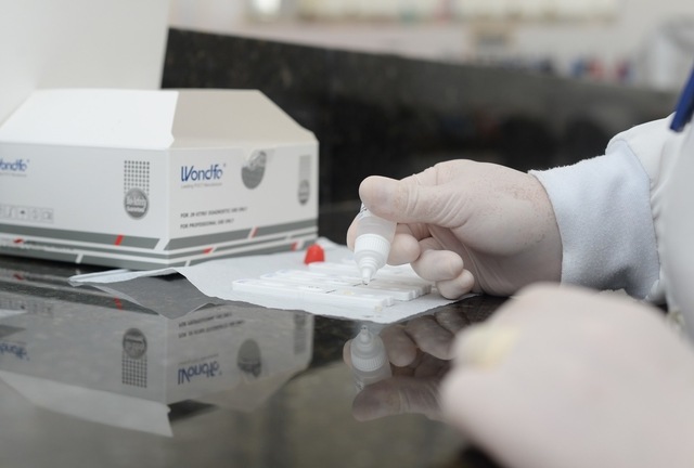 MPTO recomenda que Estado autorize testes rápidos da Covid-19 em farmácias e drogaria de Palmas