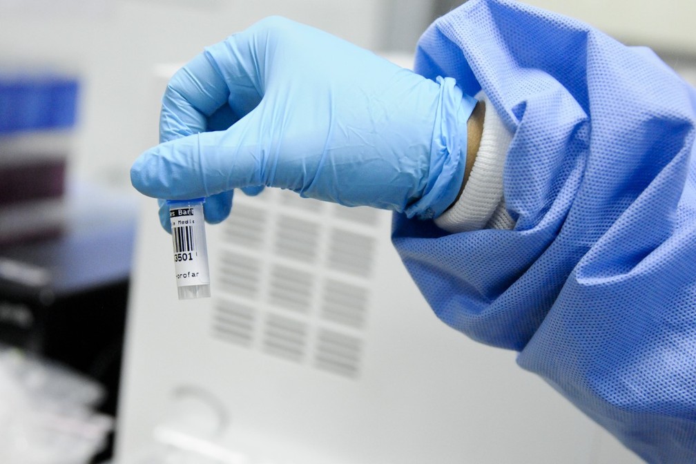 Brasileiros desenvolvem teste rápido e barato para coronavírus que prevê complicações