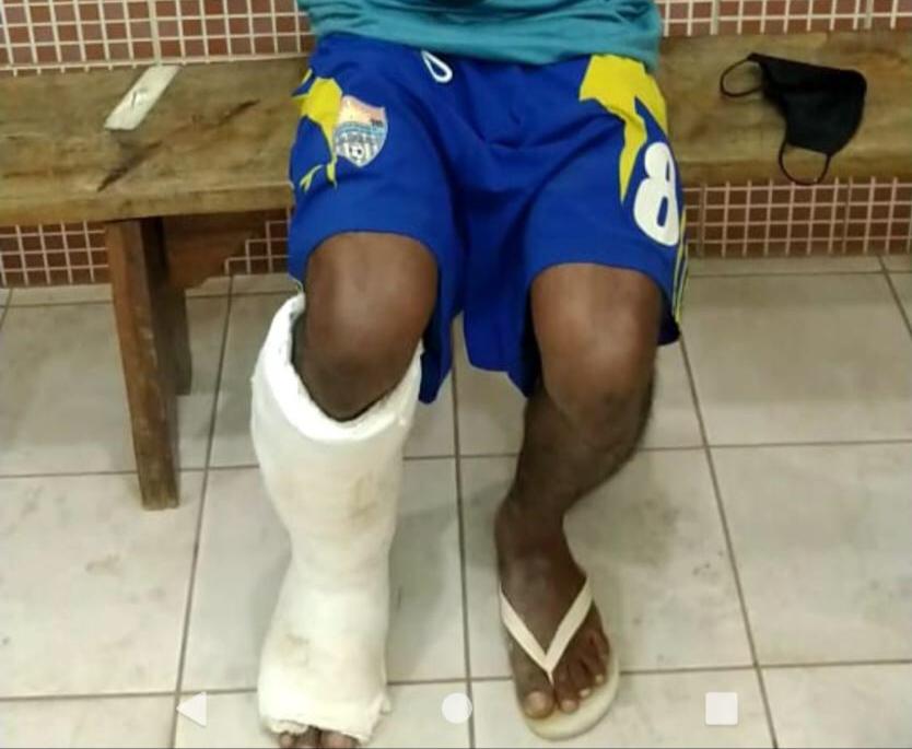 Homem com falsa fratura na perna forja a própria prisão para ingressar na CPP de Palmas com ilícitos