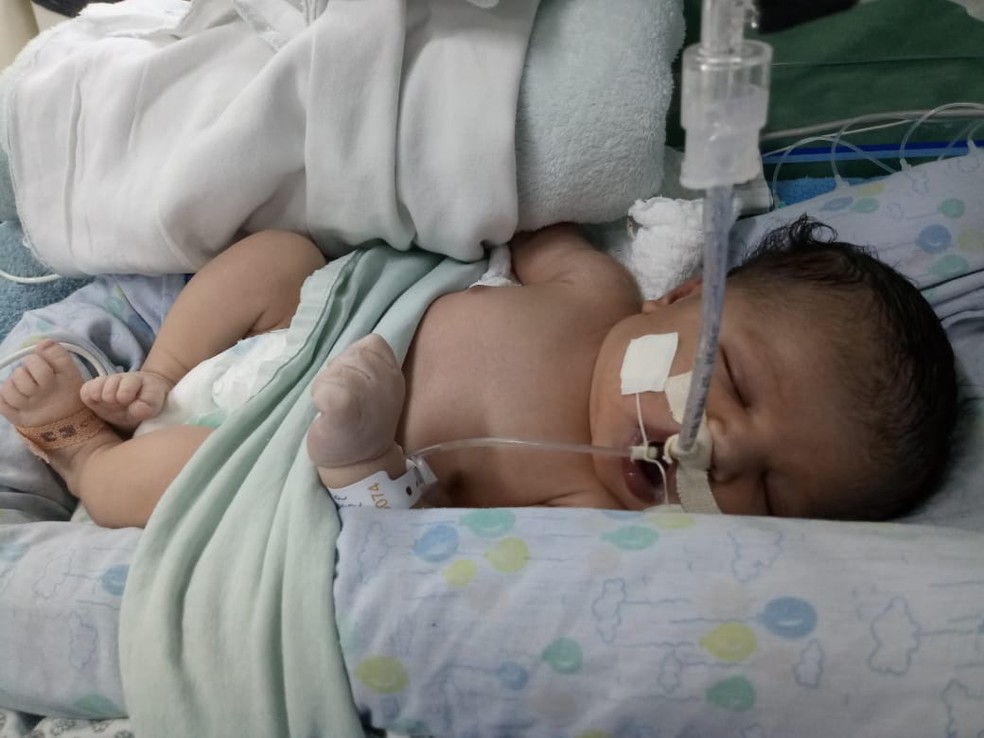 Após 22 dias aguardando cirurgia em Hospital de Palmas, bebê com problema cardíaco é transferido para São Paulo