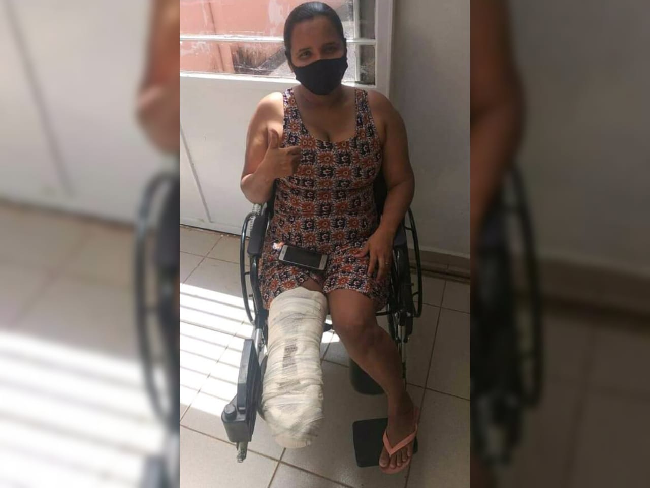 A história de Cláudia Saraiva, gari de Palmas que perdeu o pé em acidente de trânsito e luta para custear o tratamento