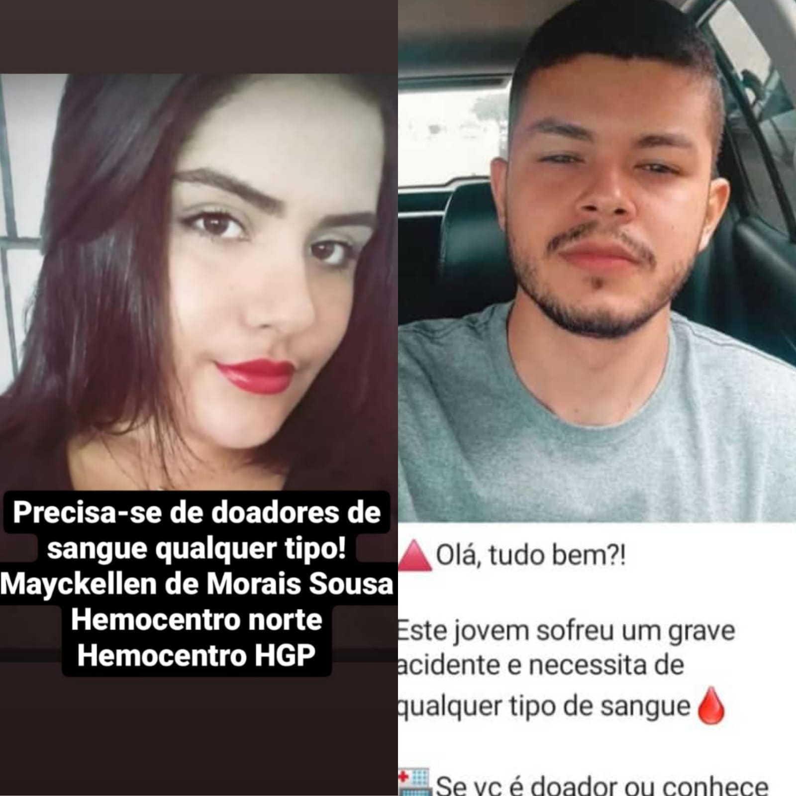 Casal de jovens vai para UTI após sofrer grave acidente na TO-020 em Palmas; família pede doações de sangue