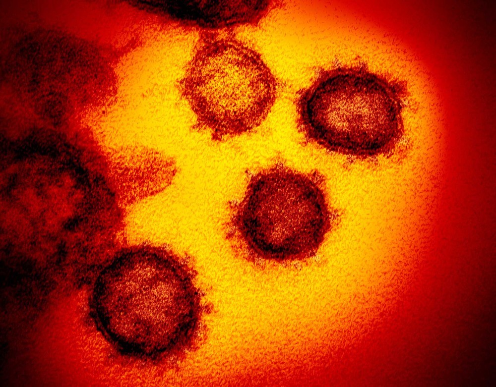 COVID-19: Coquetel da vacina AstraZeneca reduz casos graves e mortes pela doença, diz farmacêutica