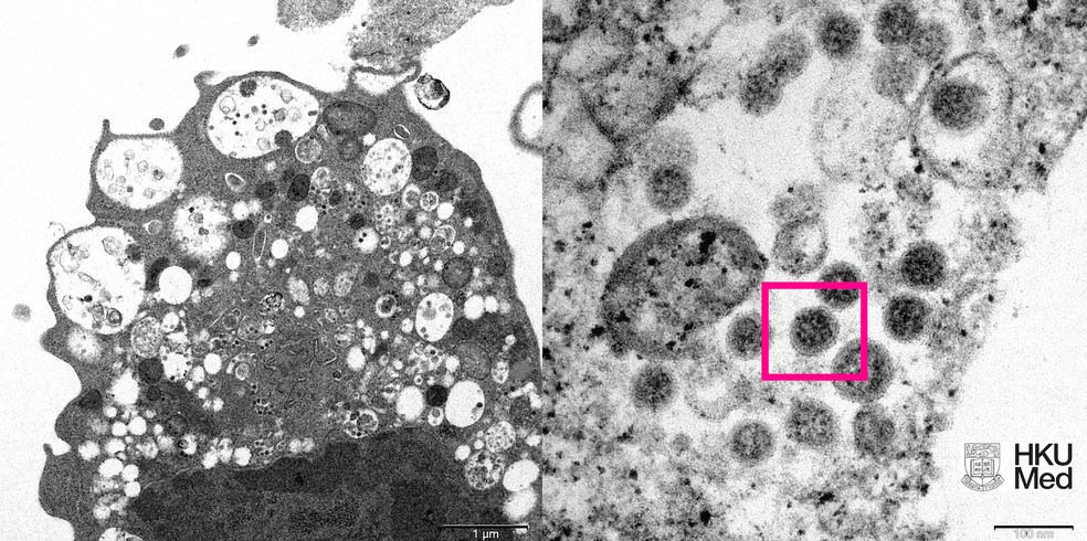 Covid-19: Reino Unido registra primeira morte pela variante ômicron