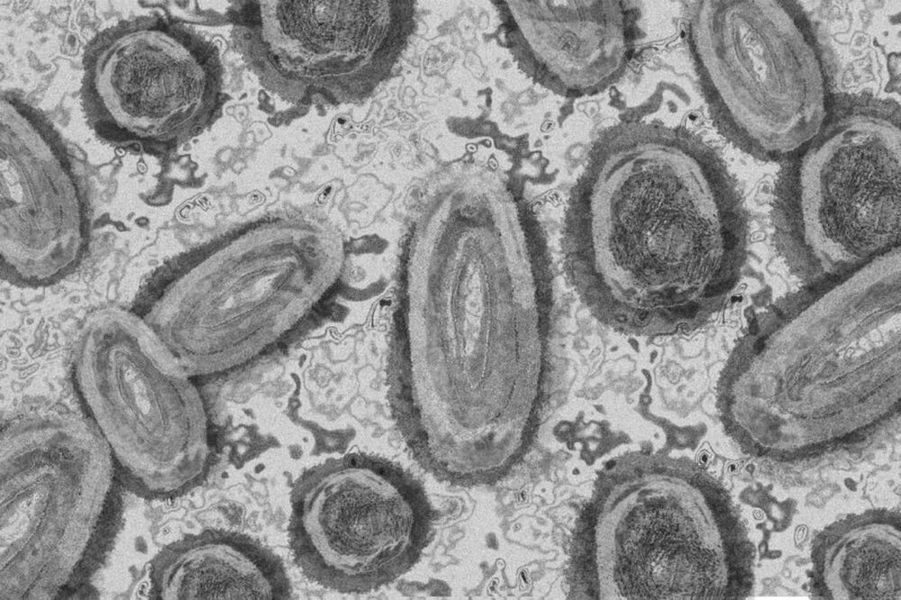 Brasil tem mais de 20 casos confirmados de varíola dos macacos, informa Ministério da Saúde