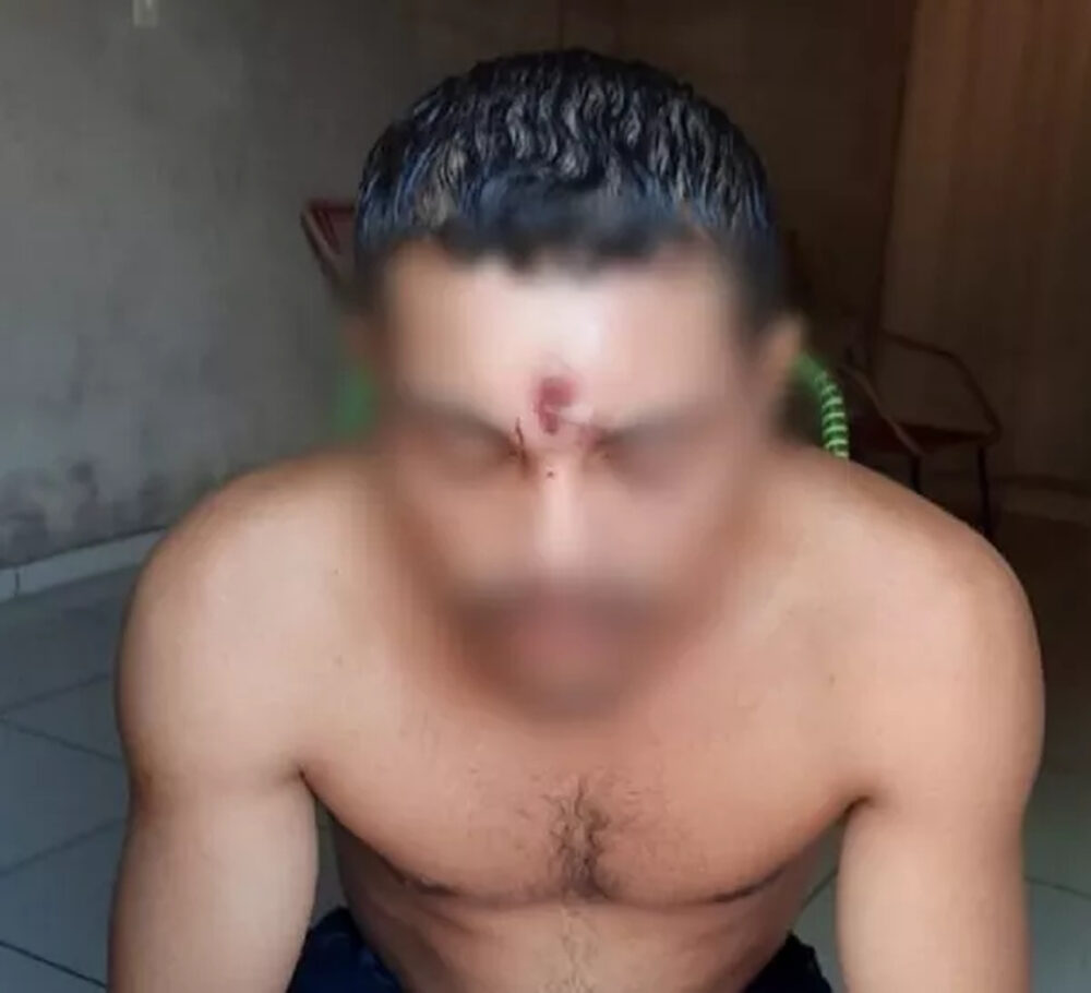 Homem vai para casa dormir depois de levar um tiro na testa enquanto andava de moto em Araguaína