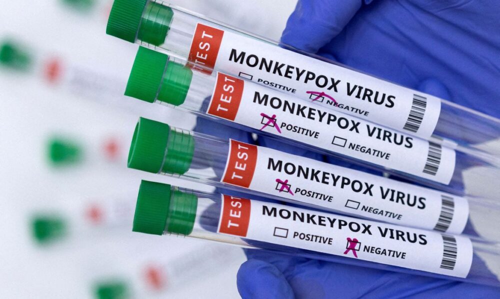 Saúde divulga dados sobre a Varíola dos Macacos; 13 casos estão sendo investigados no Tocantins
