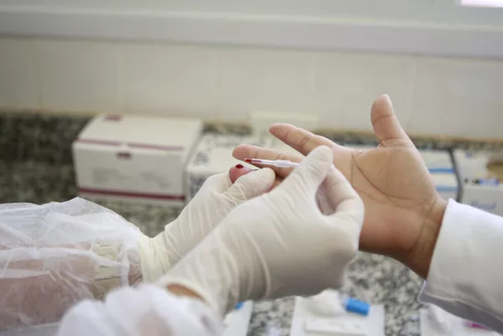 Palmas oferta teste rápido gratuito de sífilis em unidades de saúde