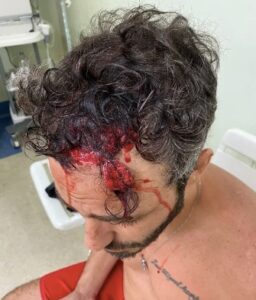 Ator Thiago Rodrigues é espancado brutalmente por criminosos durante assalto no Rio de Janeiro; Veja foto
