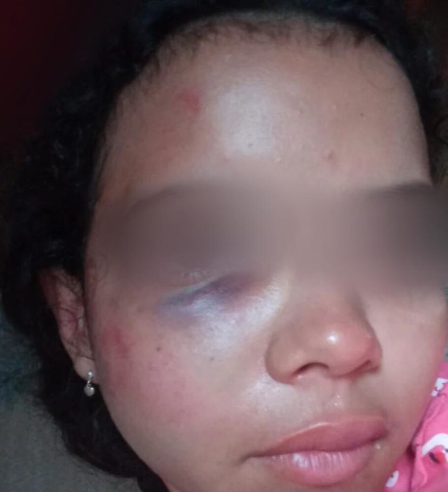 Jovem de 17 anos é agredida pelo ex-namorado e pela tia dele em Taquaralto, na região Sul de Palmas