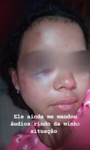Jovem de 17 anos é agredida pelo ex-namorado e pela tia dele em Taquaralto, na região Sul de Palmas