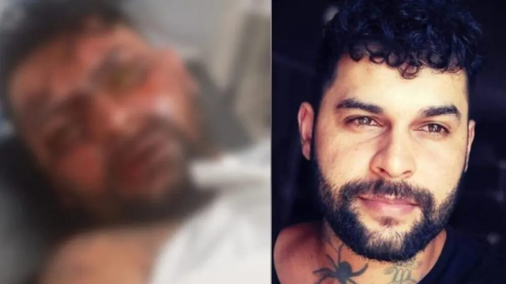 Tatuador fica cego após ex-namorada jogar soda cáustica no rosto dele em saída de academia, em Campo Grande