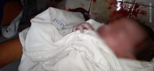 Em Gurupi: Mãe dá à luz em banheiro de maternidade após ficar mais de uma hora aguardando por atendimento