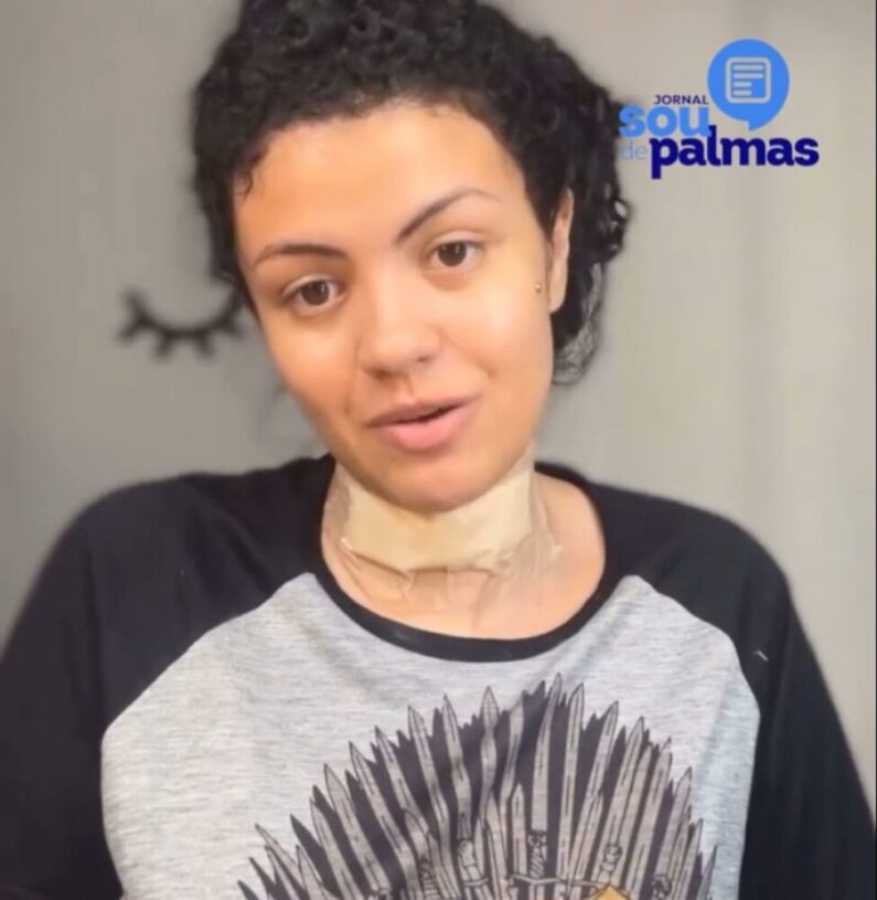 VÍDEO: Jovem que sofreu ataque em supermercado de Palmas usa redes sociais para relatar como aconteceu o caso: ''Acredito muito que foi um livramento de Deus''