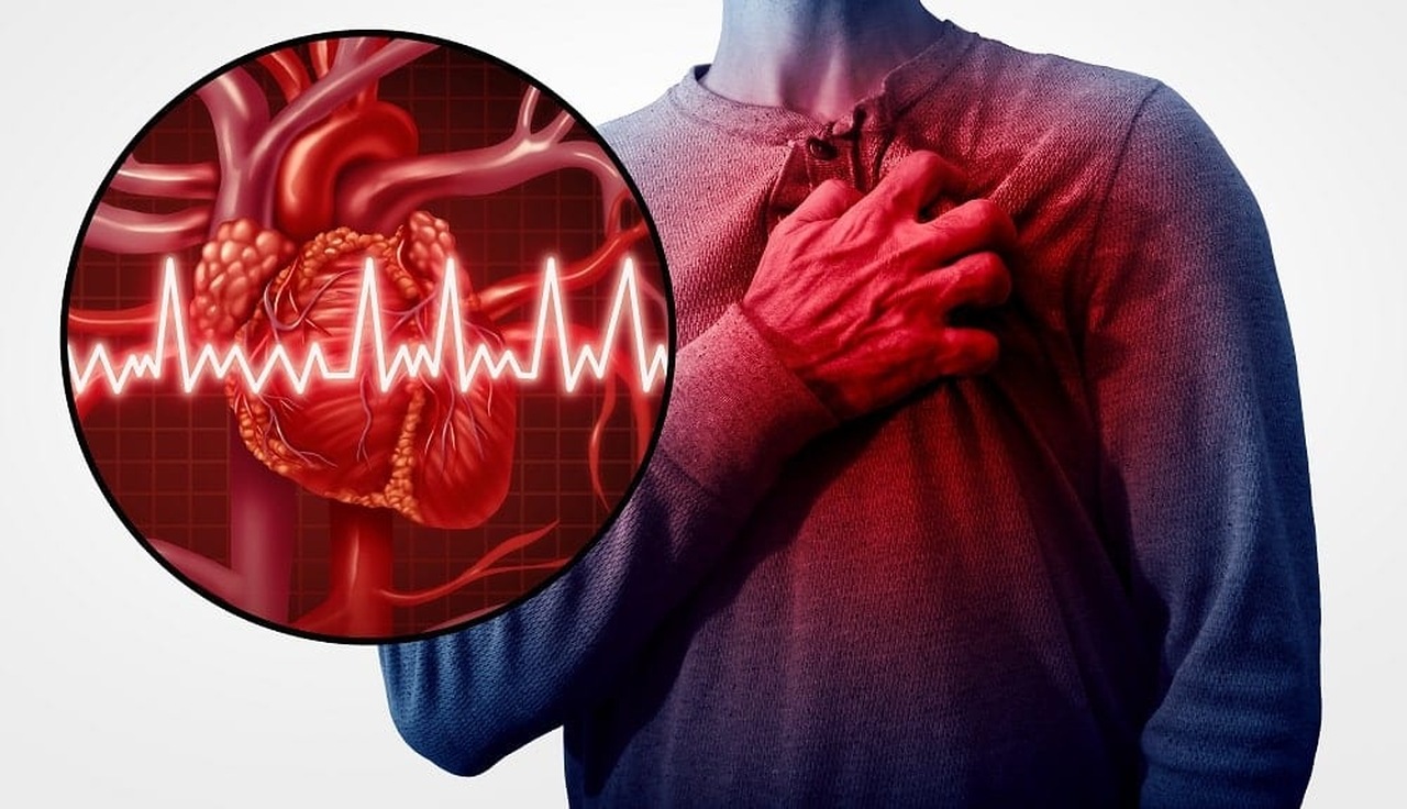 Por que casos de infarto em jovens têm aumentado; entenda