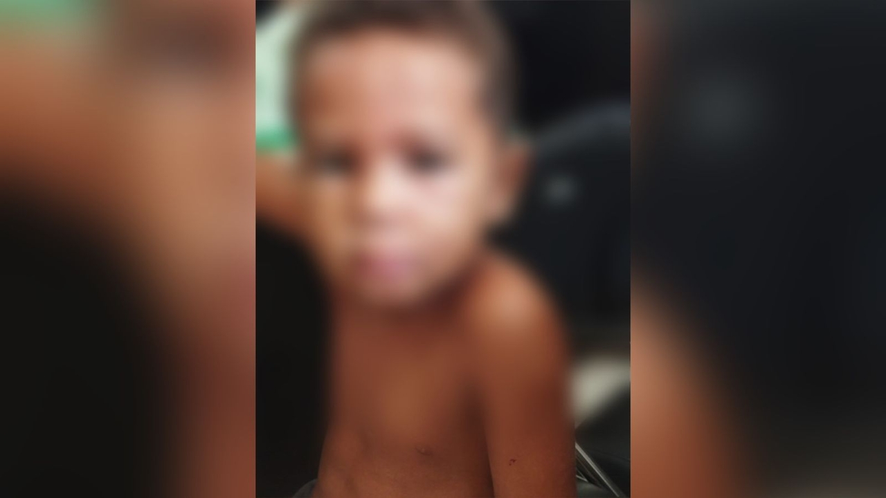 COVARDIA: Mãe é presa em flagrante após espancar filho de 4 anos em praça pública na região sul de Palmas