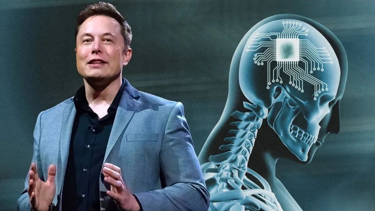 Teria coragem? Empresa de Elon Musk busca voluntário para primeiro teste com implantes cerebrais em humanos; entenda