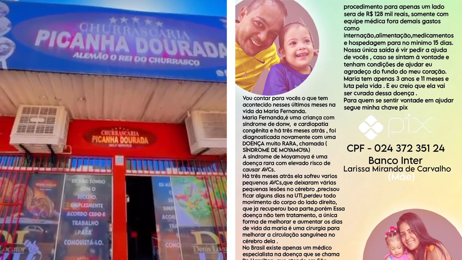 Churracaria Picanha Dourada, em Taquaralto, realiza ação solidária nesta terça (7), em prol de cirurgia para criança diagnosticada com síndrome de moyamoya