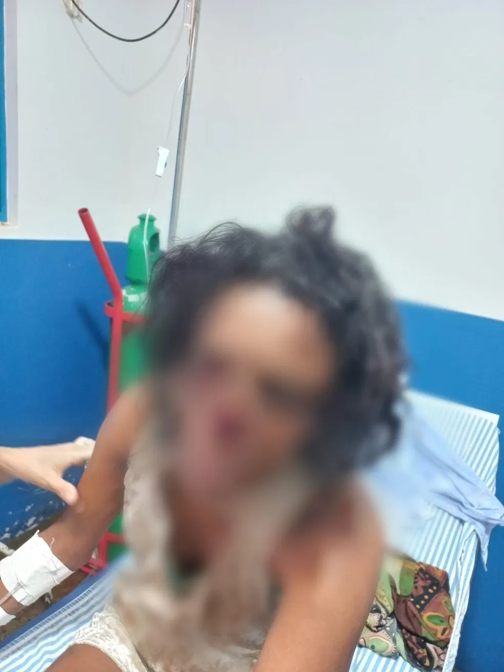 Absurdo! Marido arranca nariz da esposa com mordida durante briga em Colméia