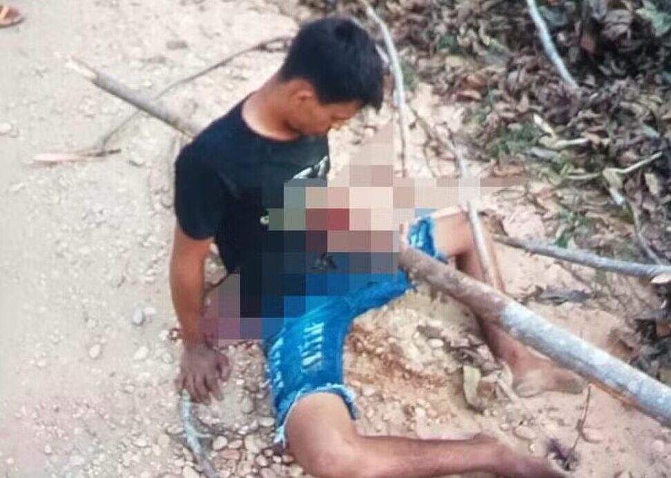 No norte do Tocantins, jovem de 20 anos sofre acidente de moto e acaba com um tronco atravessado no peito
