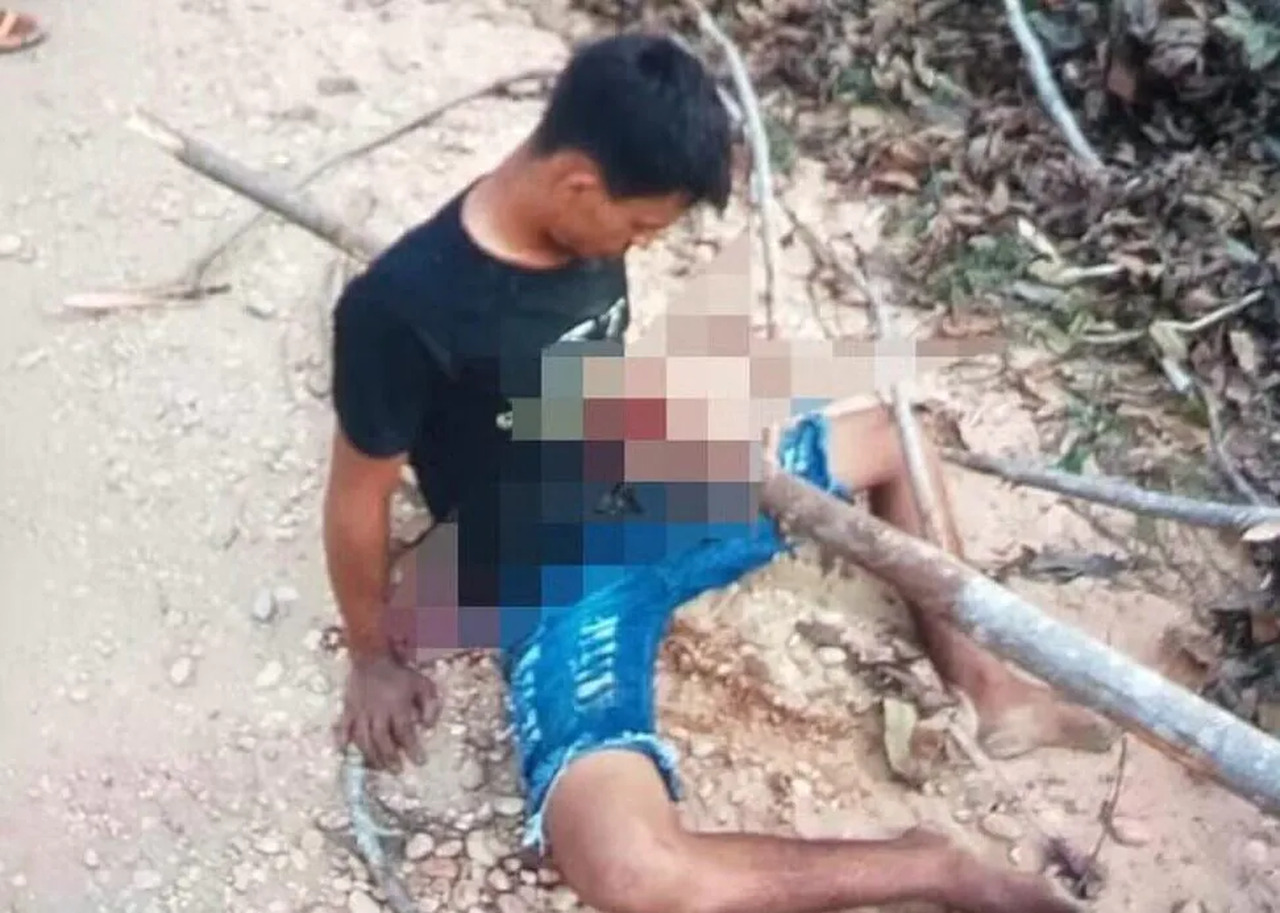 Jovem de 20 anos que sofreu acidente e teve o corpo atravessado por um tronco morreu após 25 dias de internação em Araguaína