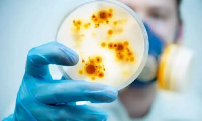 Vírus letal chamado de 'comedor de ânus' preocupa cientistas no Japão; entenda mais sobre a doença