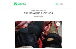 Entregador de aplicativo sofre acidente em Palmas e precisa de cirurgia urgente nos joelhos; VEJA COMO AJUDAR