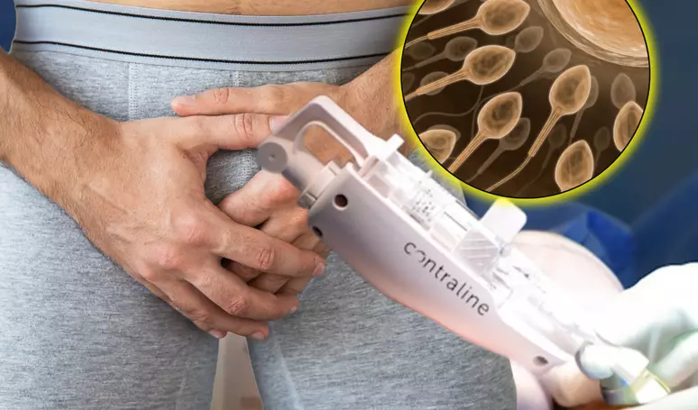 Contraceptivo masculino não hormonal avança e pode chegar ao mercado até 2028, dizem desenvolvedores; saiba detalhes