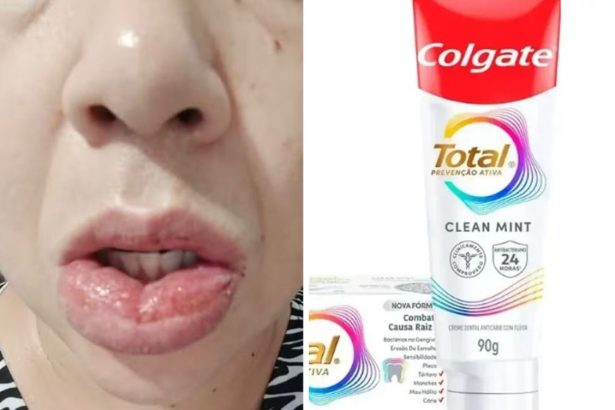 Colgate retira de mercado o creme dental Total Prevenção Ativa após interdição da Anvisa por reações adversas