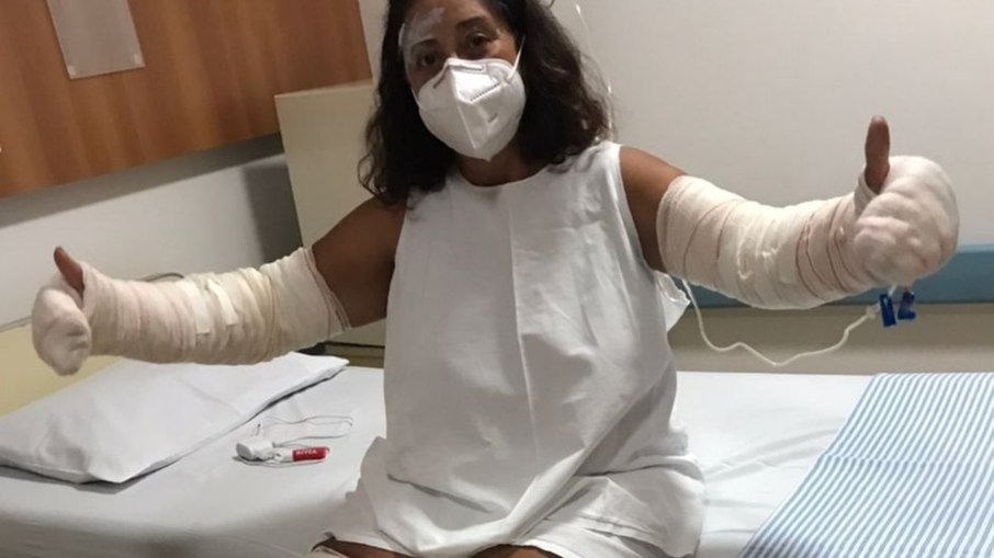 Mulher tem 40% do corpo queimado após explosão de desodorante, em Goiás